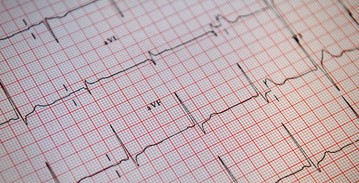 Paper readout from an EKG